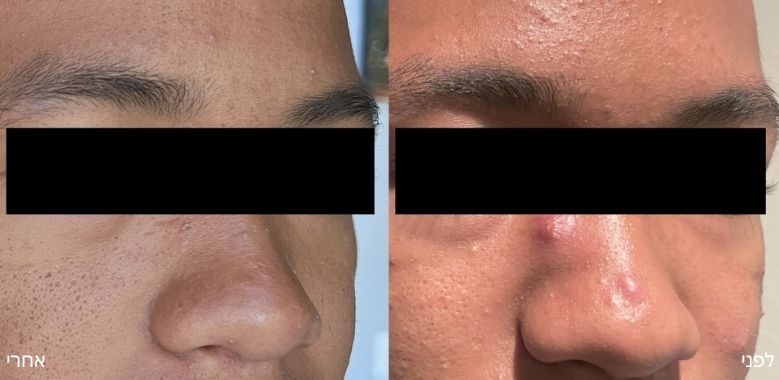 before after 2