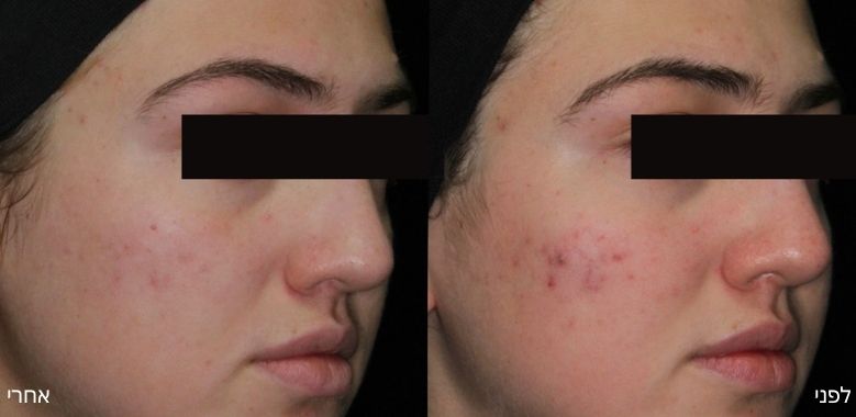 before after 3