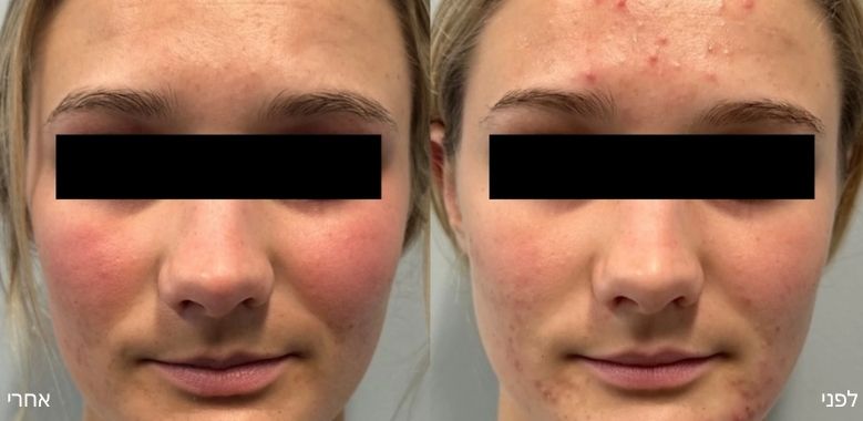 before after 5