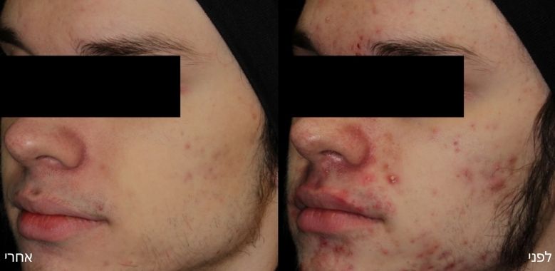 before after 6